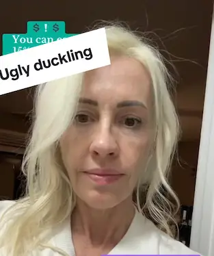 Blondify 010V